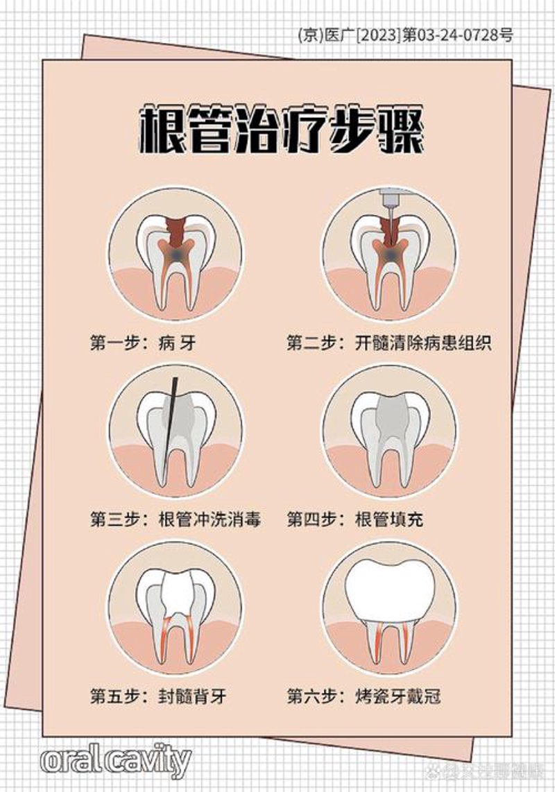 隐形矫正:选择适合自己的矫正方式