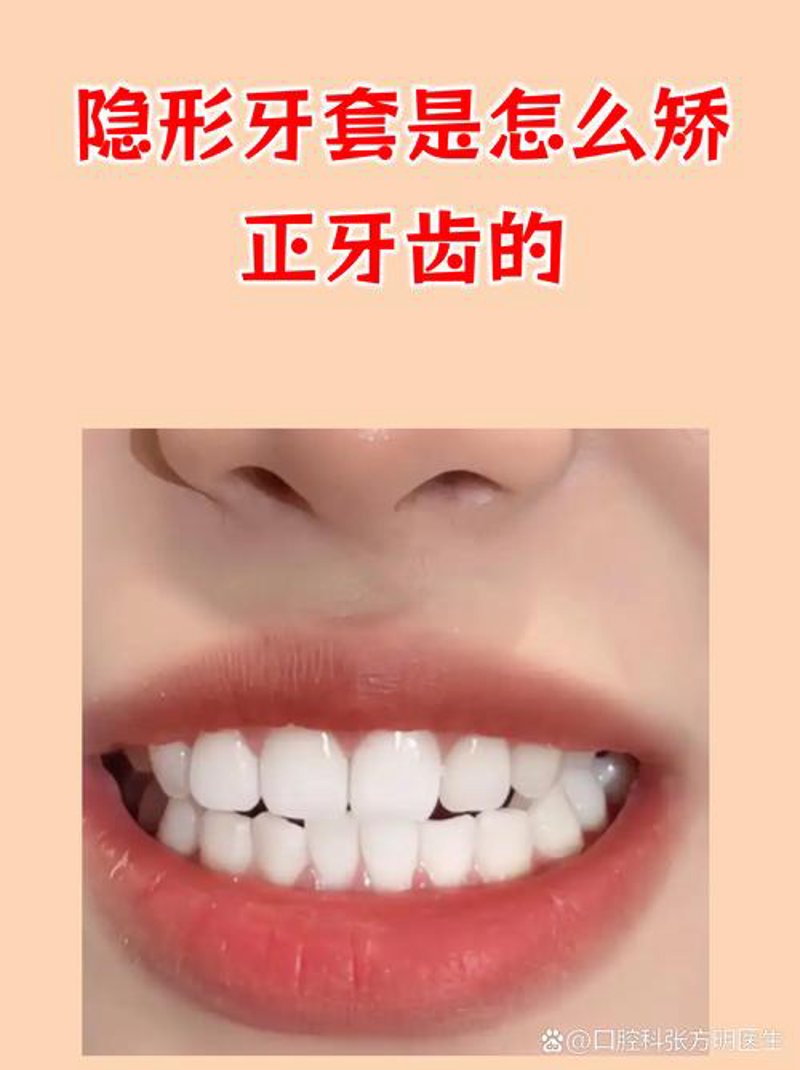 选择成都口腔门诊的正确打开方式
